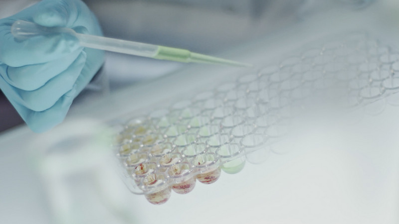 Produk perusahaan Keros Therapeutics Inc | 👁️GURU.Markets👁️ Barang utama Keros Therapeutics Inc