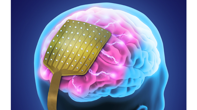 NeuroOne Medical Technologies Corp. - מוצר החברה | 👁️GURU.Markets👁️ מוצר מקורי של NeuroOne Medical Technologies Corp.